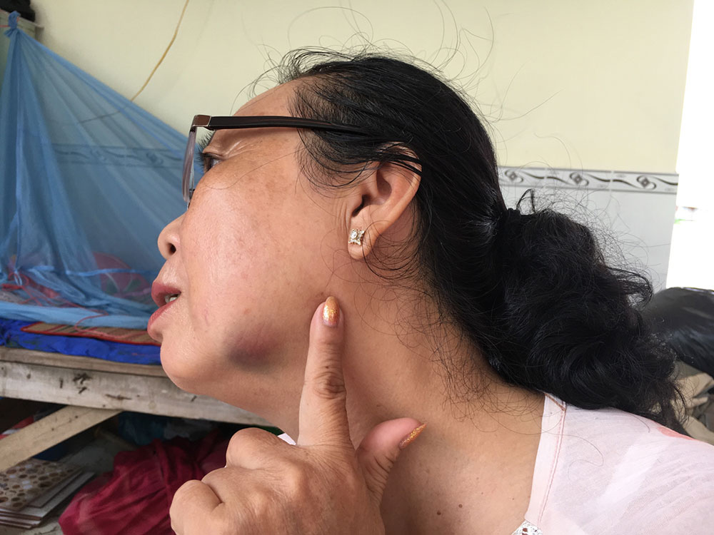Cảnh giác với “tín dụng đen”