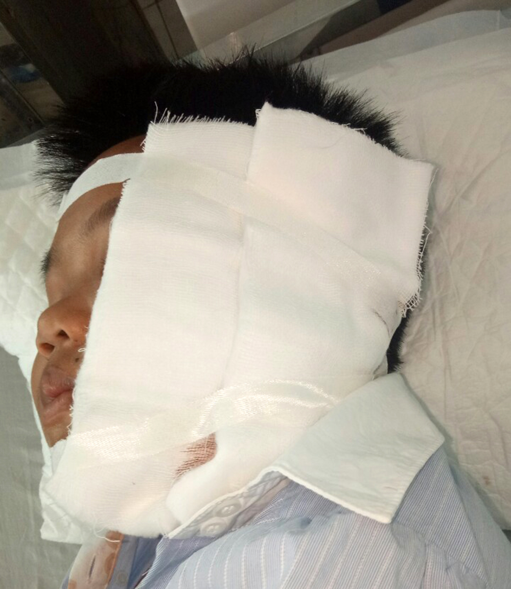 Cảnh báo tai nạn nghiêm trọng do trẻ chơi nghịch Cảnh báo tai nạn nghiêm trọng trẻ em do đùa giỡn