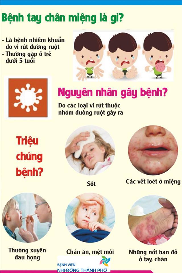 Nhận biết bệnh tay chân miệng ở trẻ khi vào mùa dịch