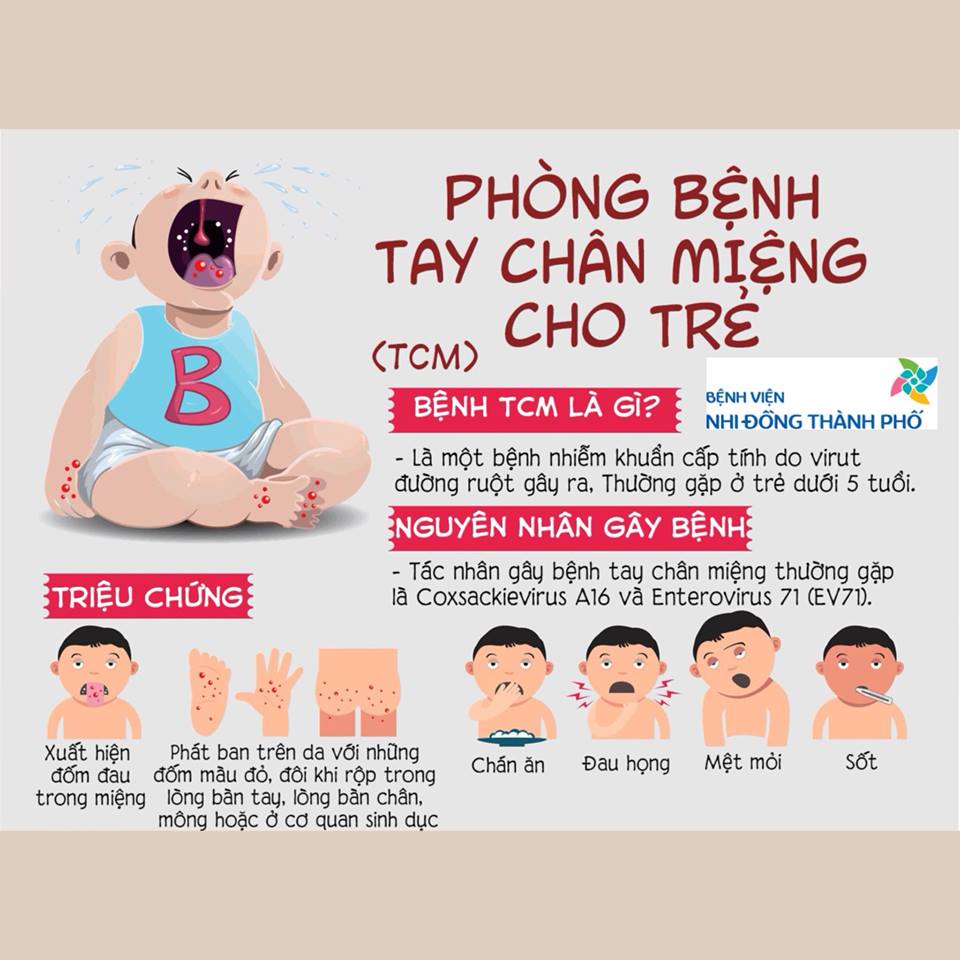 Nhận biết bệnh tay chân miệng ở trẻ khi vào mùa dịch