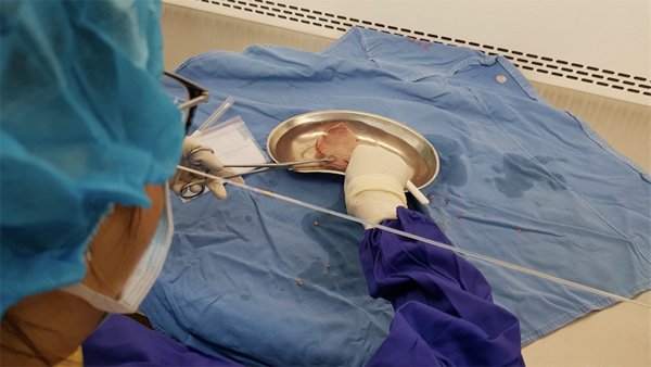 Việt Nam có ngân hàng mô đầu tiên, bảo quản từ xương sọ tới van tim Việt Nam có ngân hàng mô đầu tiên, bảo quản từ xương sọ tới van tim