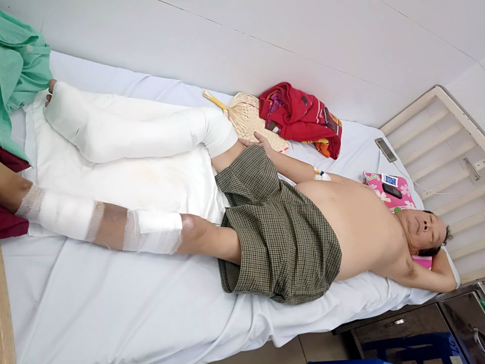Thầy giáo có nguy cơ bị tháo khớp