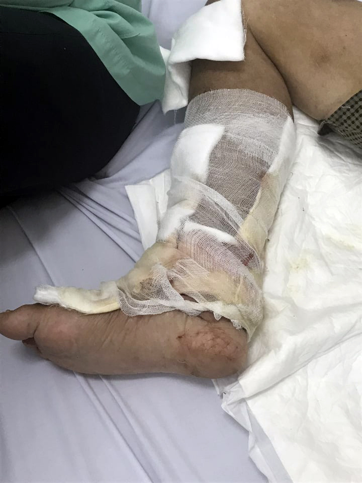 Thầy giáo có nguy cơ bị tháo khớp