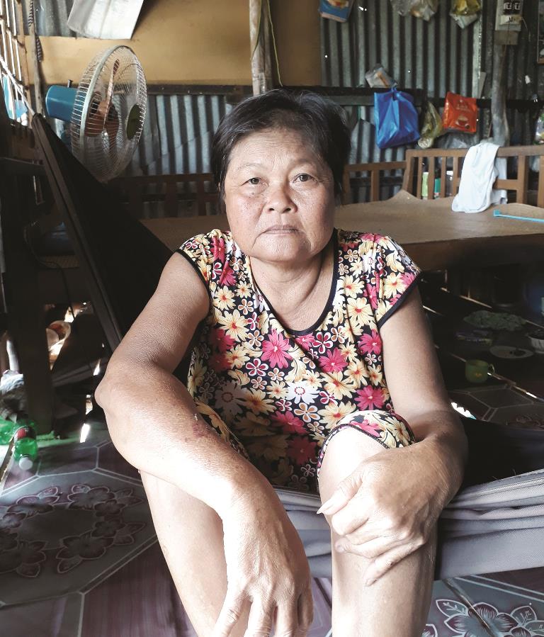 Người phụ nữ suy thận cần được giúp đỡ