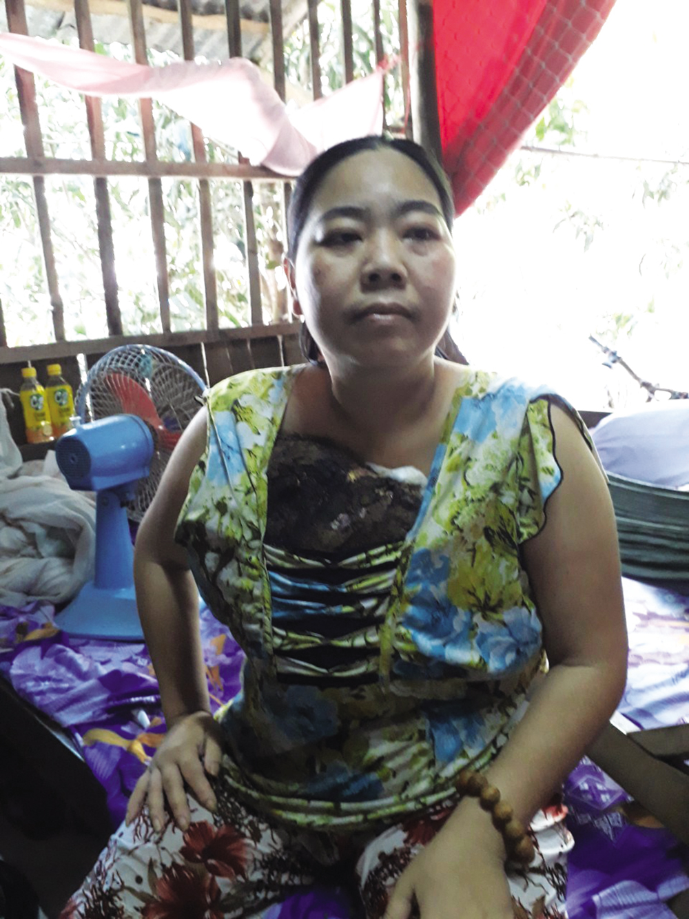 Xót thương cảnh người phụ nữ bị bướu diệp thể