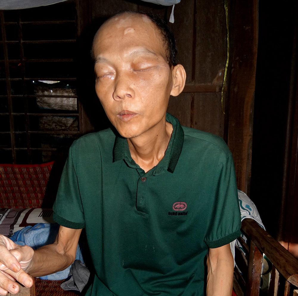 Hết tiền chữa trị bệnh Hết tiền chữa trị bệnh