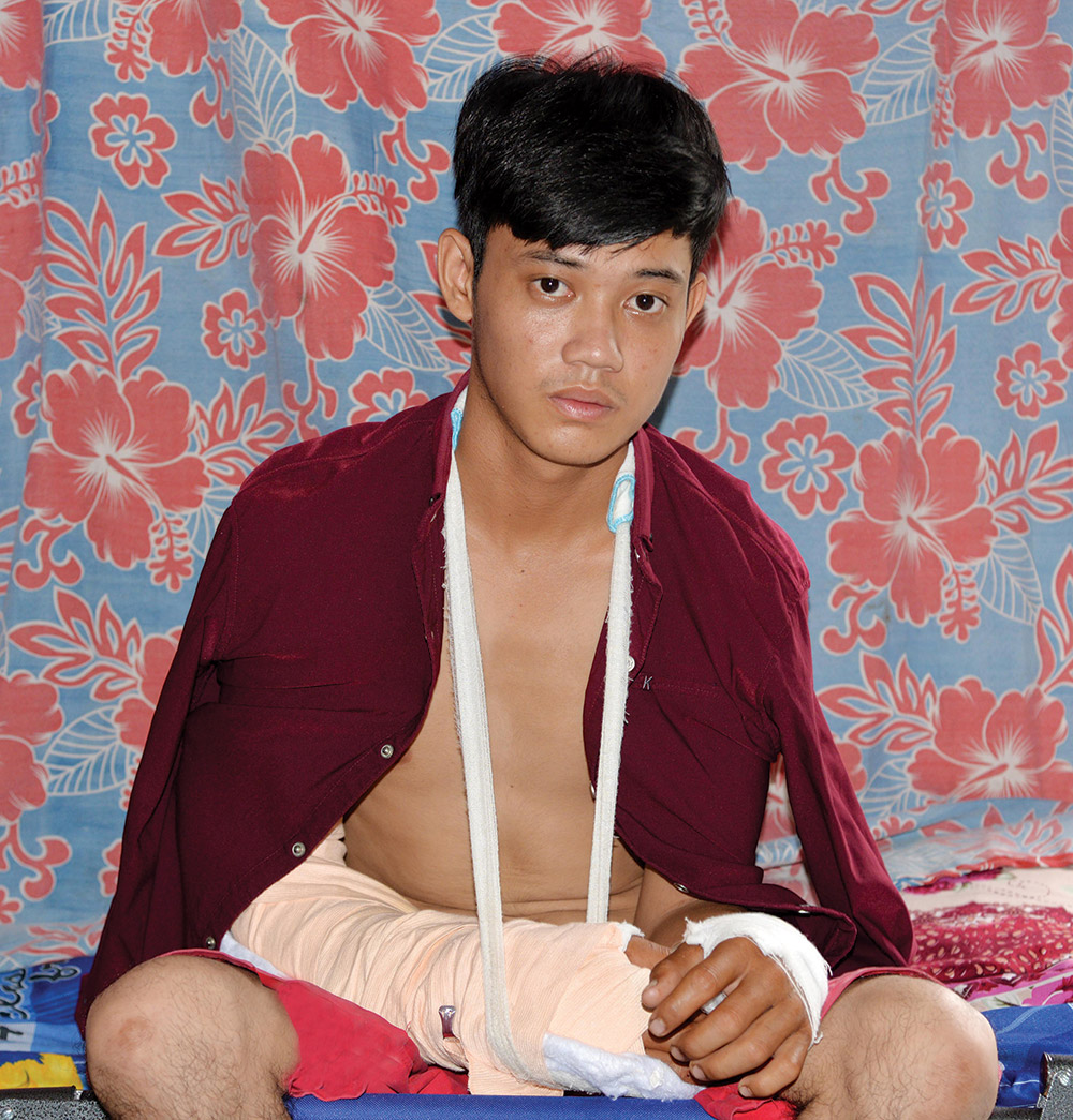 Hoàn cảnh khó khăn của thanh niên bị sét đánh Liêu Kim Phi với vết thương ở hai cánh tay do sét đánh