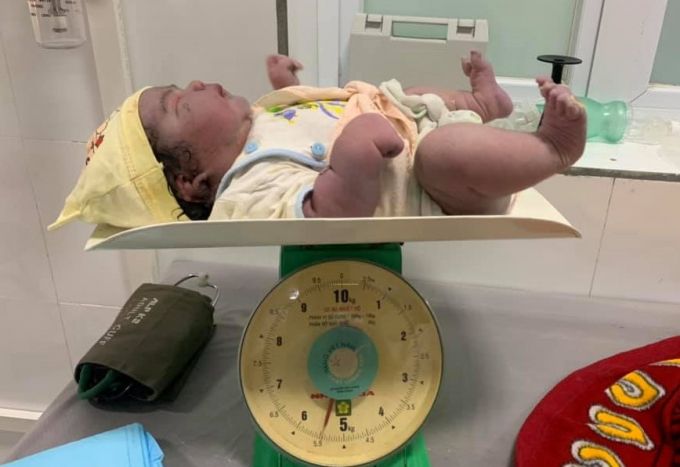 Sản phụ lập kỳ tích trong ngày 20-10, khi sinh thường một bé gái nặng đến 5,5 kg