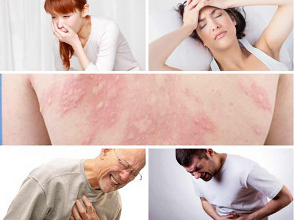 Sốc phản vệ - Xử lý sao cho đúng? Sốc phản vệ - Xử lý sao cho đúng?