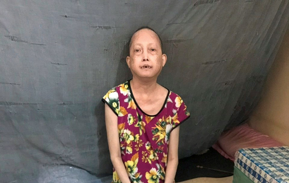 Thương một phụ nữ mắc bệnh xơ cứng bì