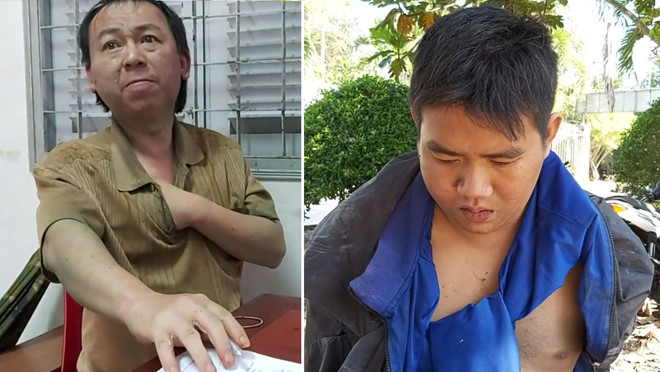 Tiền Giang: Trộm chó ép xe làm 1 công an viên bị thương