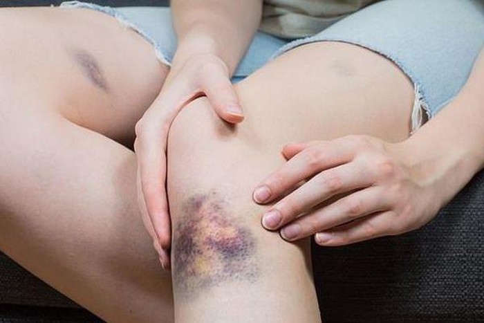 4 biểu hiện thường thấy trong cơ thể là tiền thân của ung thư