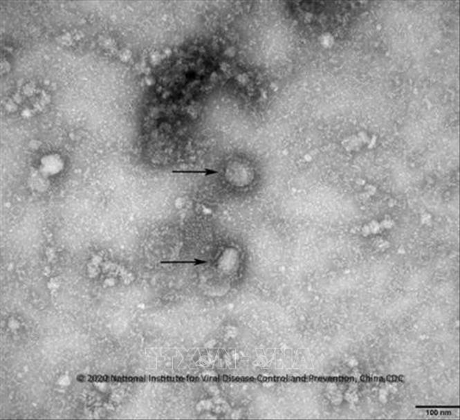 Mỹ xác nhận trường hợp nhiễm virus corona đầu tiên