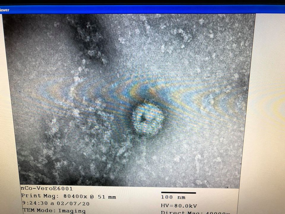 Việt Nam nuôi cấy và phân lập thành công virus Corona