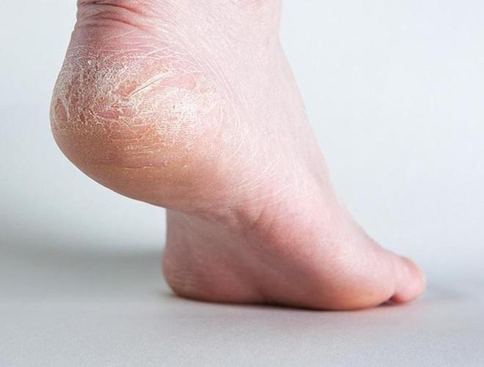 Công dụng tuyệt vời của những loại vỏ tưởng chừng bỏ đi