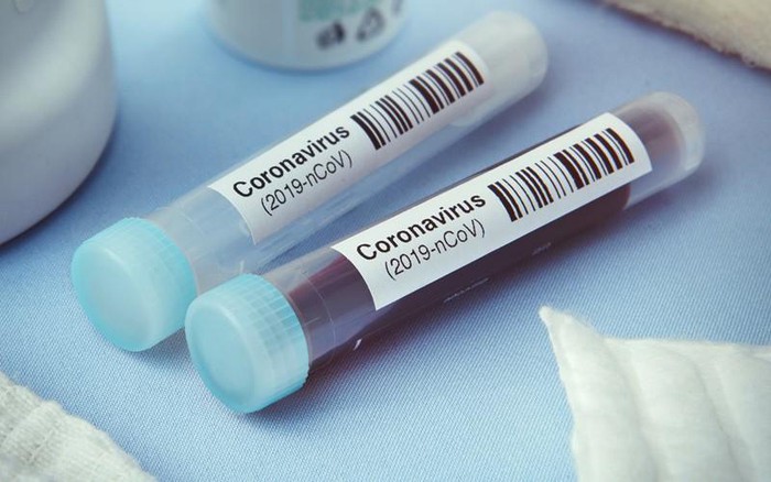 Hôm nay, Hà Nội bắt đầu xét nghiệm nhanh Covid-19 diện rộng