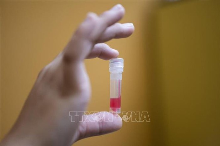 Roche phát triển xét nghiệm huyết thanh để phát hiện kháng thể COVID-19