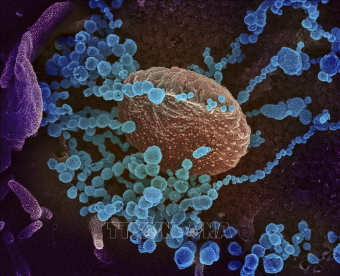Các nhà khoa học Argentina chụp được ảnh virus SARS-CoV-2 lây nhiễm trong nước
