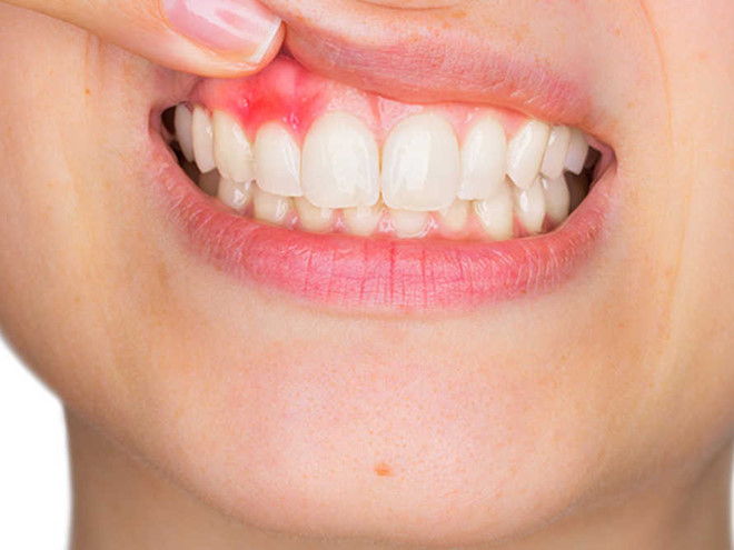 Gặp 5 triệu chứng kỳ lạ này, hãy mau đi khám tiểu đường!