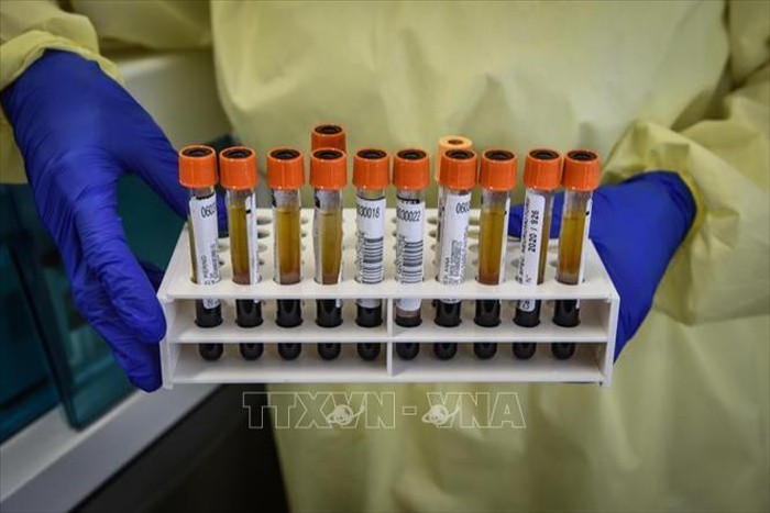 Italy đang nghiên cứu 5 - 6 loại vaccine triển vọng phòng COVID-19