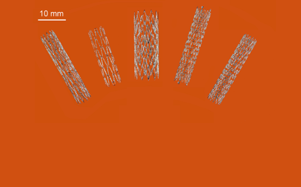 Australia tạo đột phá trong sản xuất stent nhờ công nghệ in 3D