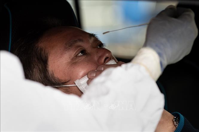 Nhật Bản sẽ thử nghiệm sử dụng tế bào gốc để chữa trị cho bệnh nhân COVID-19