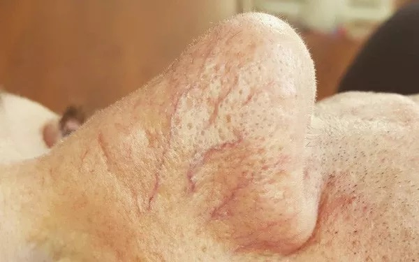 Gan bị tổn thương sẽ thông báo cho bạn biết qua 4 tình trạng khác lạ xuất hiện trên da