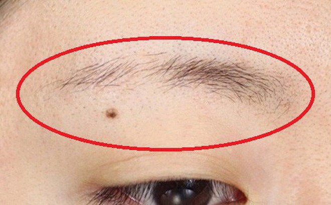 6 dấu hiệu bất thường trên khuôn mặt “hé lộ” những bệnh nguy hiểm sắp ập đến