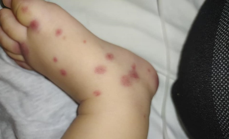Cứu kịp thời bệnh nhi mắc căn bệnh cực hiếm, chưa có trong y văn Việt Nam