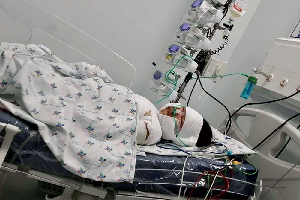 Bé gái bị bỏng nặng cần được giúp đỡ