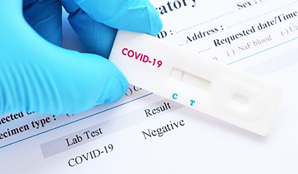 An Giang phân bổ 20.000 test xét nghiệm kháng nguyên SARS-CoV-2 do Tập đoàn T&T tặng