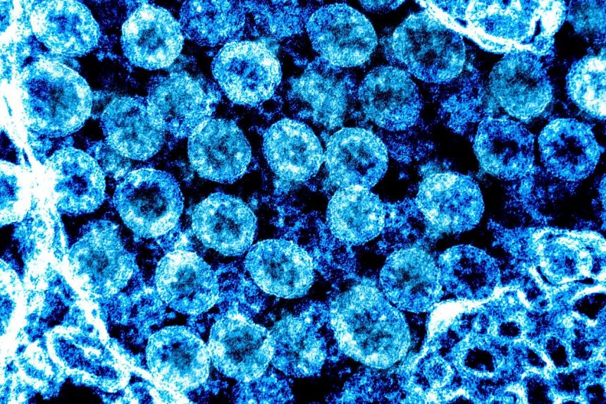 Virus SARS-CoV-2 thay đổi hình dạng để tăng khả năng sống sót