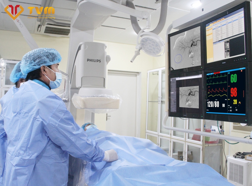 Ứng dụng phương pháp chụp và nút mạch điều trị ung thư gan nguyên phát