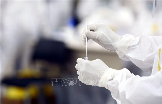 Bộ Y tế yêu cầu các tỉnh, thành phố tăng cường công tác xét nghiệm SARS-CoV-2