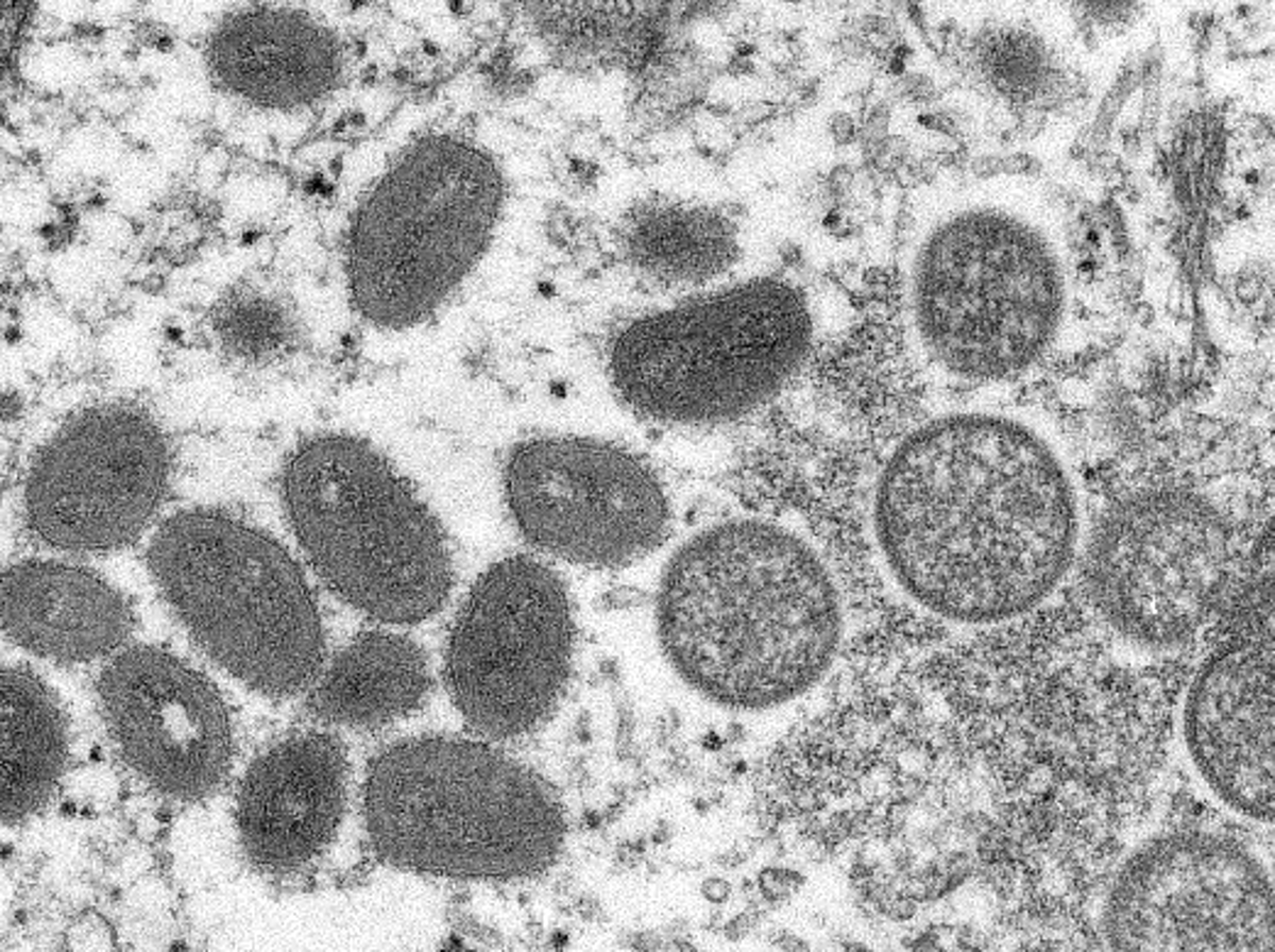 WHO: Không có bằng chứng cho thấy virus đậu mùa khỉ đã biến đổi