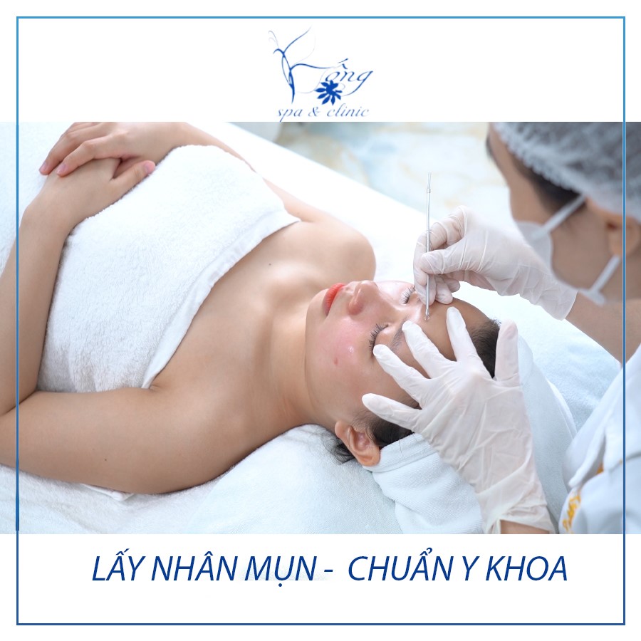 Spa chăm sóc da sẹo cho nam cần lưu ý gì?