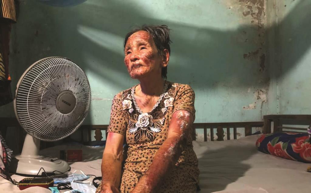 Người bị phỏng, người đau bệnh cần giúp đỡ