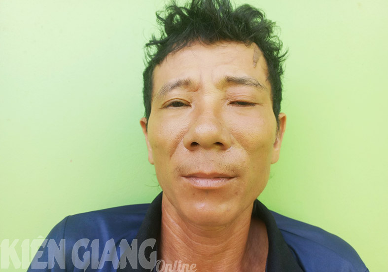 Kiên Giang: Bắt tạm giam đối tượng cố ý gây thương tích