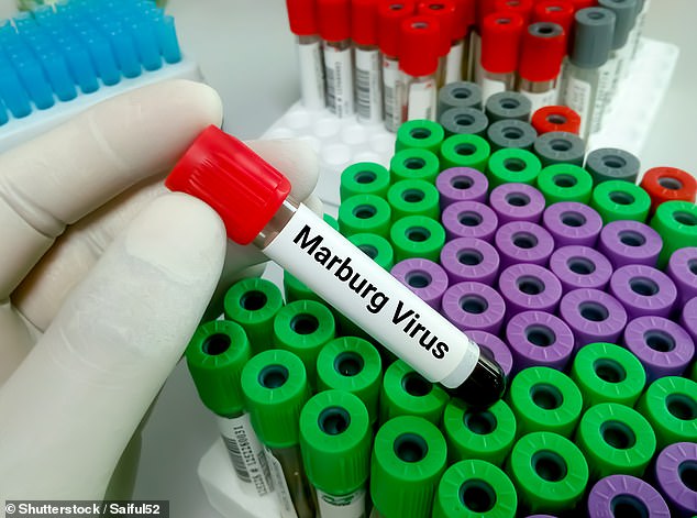 Bùng phát virus Marburg gây tử vong cao ở Tanzania