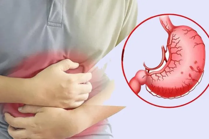 Bé trai thủng dạ dày do vi khuẩn HP, bác sĩ khuyến cáo những việc cần thay đổi trong gia đình để phòng bệnh