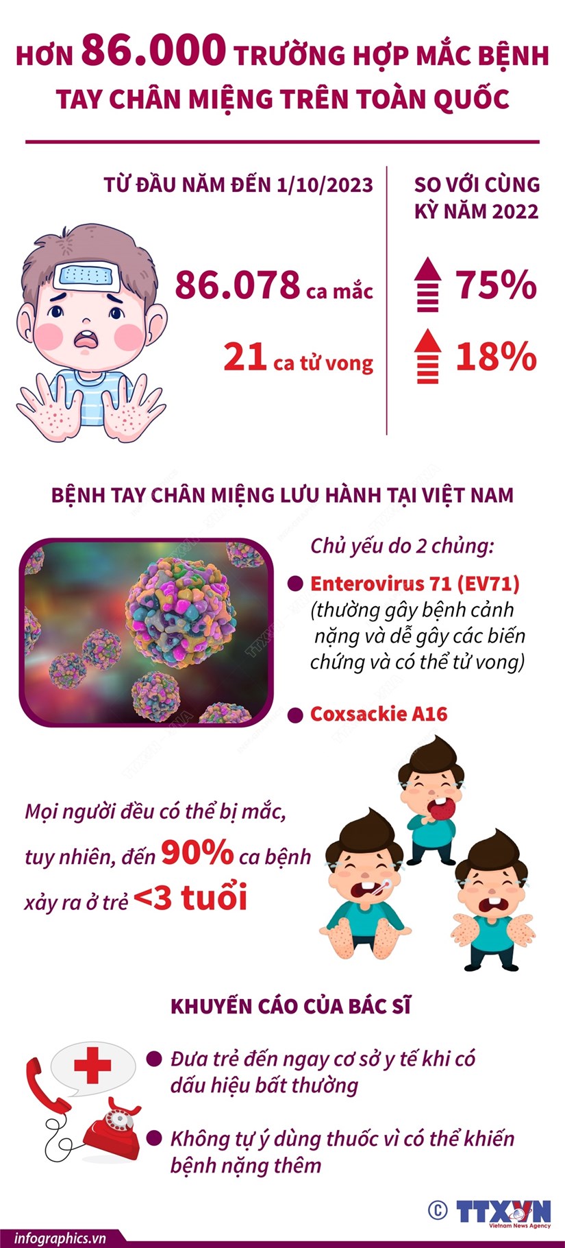 Số ca mắc bệnh tay chân miệng tăng tới 75% so với năm trước
