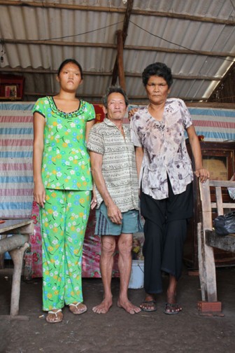 "Người vượn" ở Việt Nam khó lấy vợ, lấy chồng
