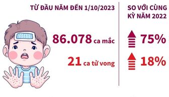 Số ca mắc bệnh tay chân miệng tăng tới 75% so với năm trước